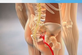 Akibat Saraf Kejepit: Gejala, Dampak, dan Cara Mengatasinya